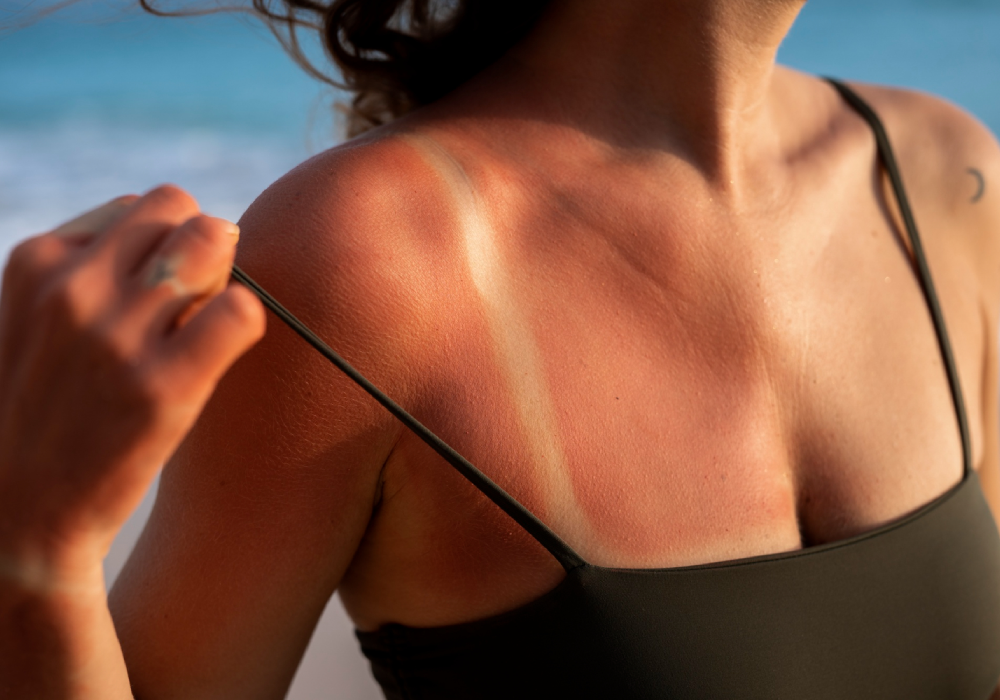 Солнцезащитный спрей Cosmolex SPF для защиты кожи от ультрафиолета