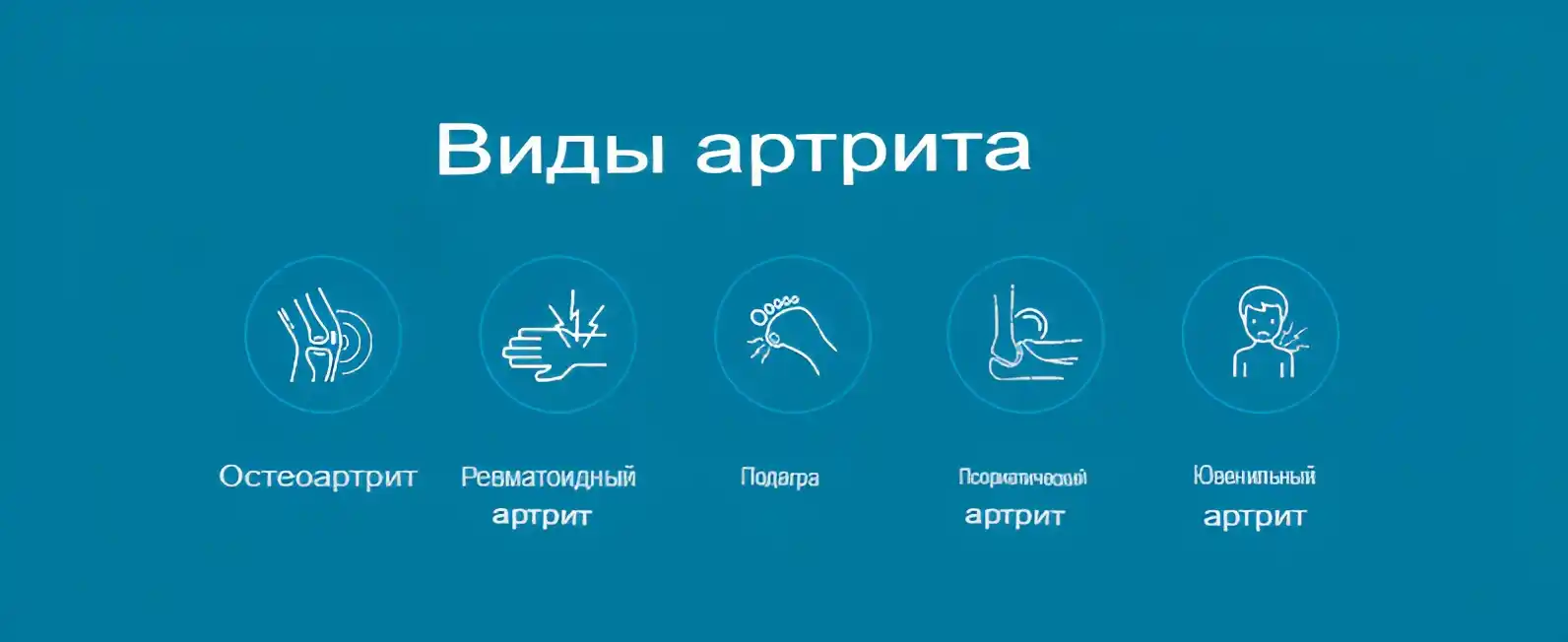 Виды артрита Виды артрита