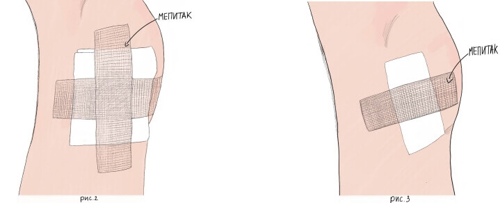 mepitac_ris2.jpg