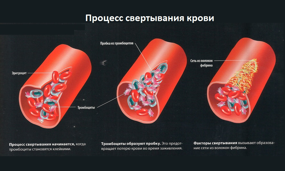 схема процесса свертываемости крови схема процесса свертываемости крови