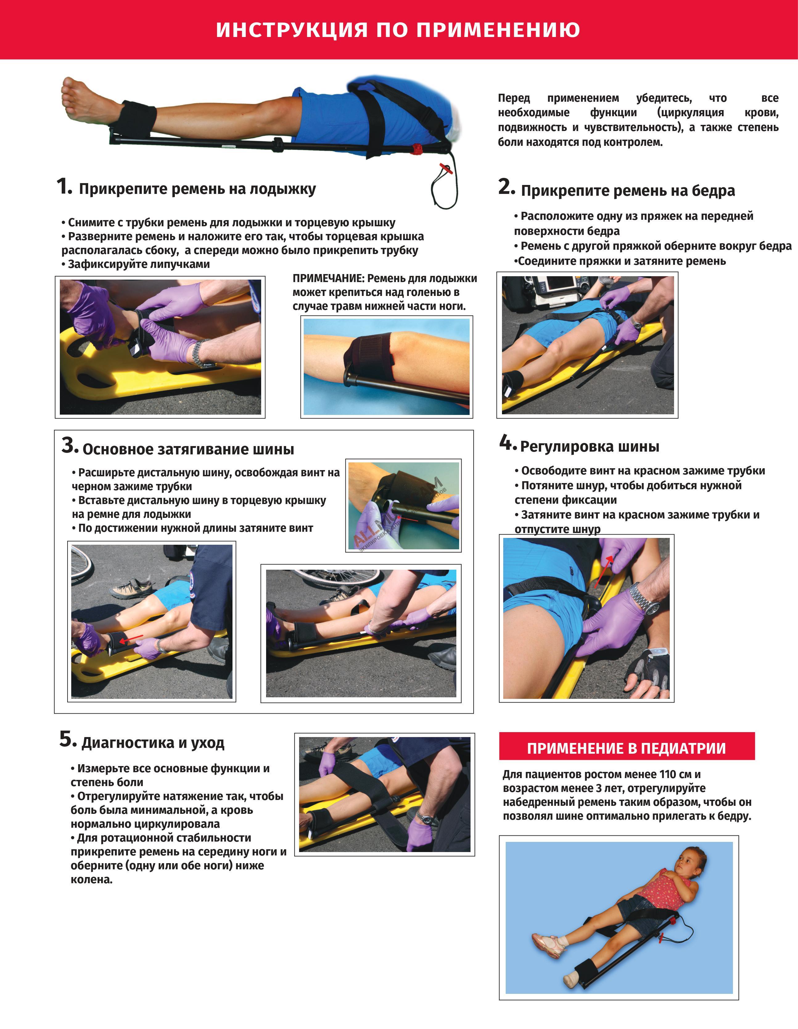 Иммобилизационная шина Slishman Traction Splint