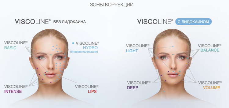 Viscoline_зоны коррекции Viscoline_зоны коррекции.jpg