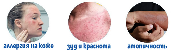 Лосьон Ламелодерм Just при аллергии на коже и зуде