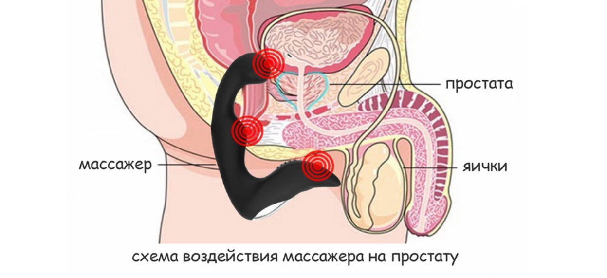 массаж простаты