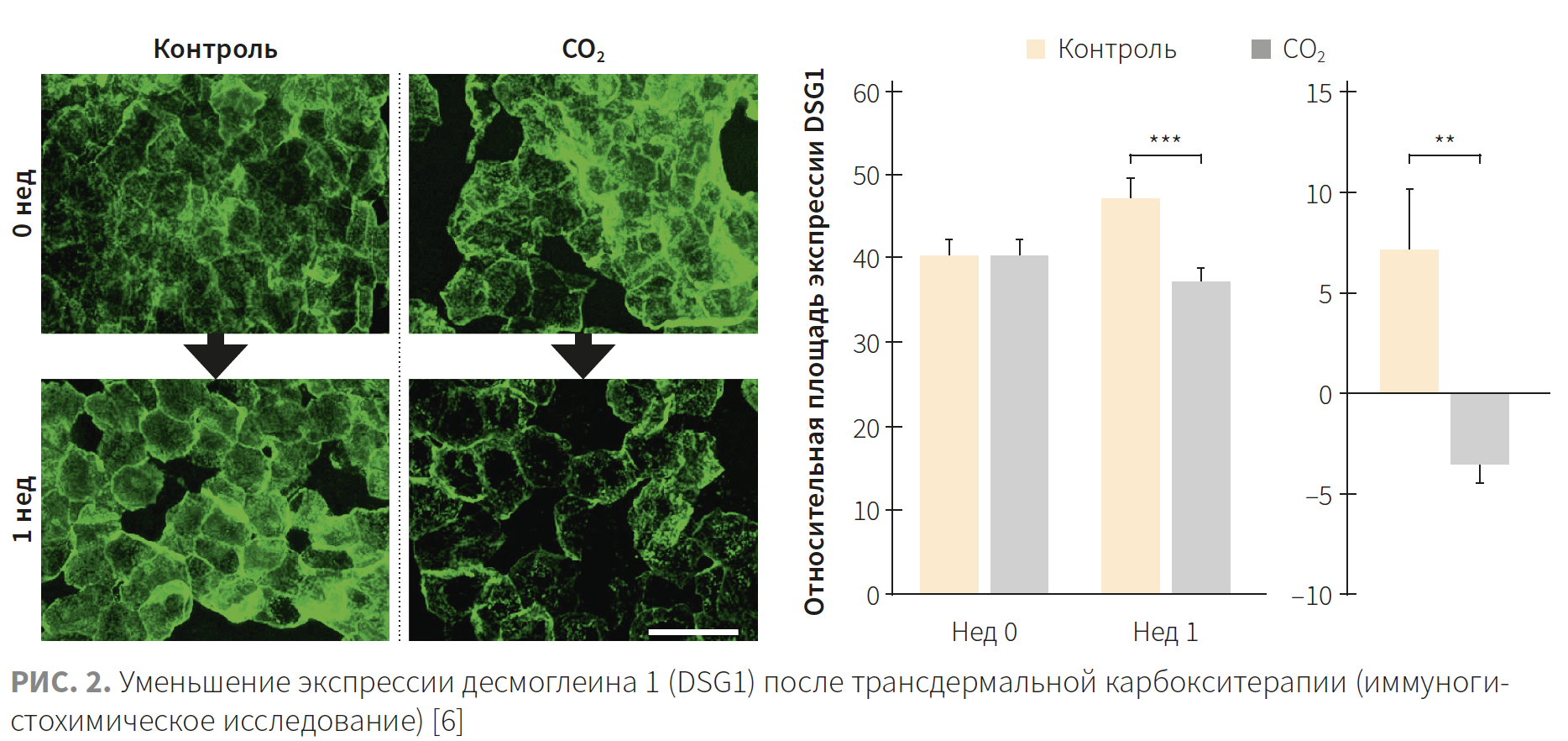 Никулина КМ 2-2023 (БТМ) Рис 2 Никулина КМ 2-2023 (БТМ) Рис 2.png