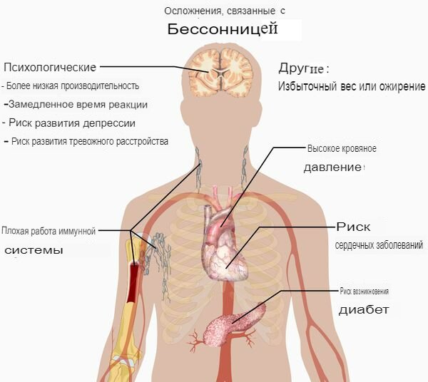 Осложнения_бессонница Осложнения_бессонница