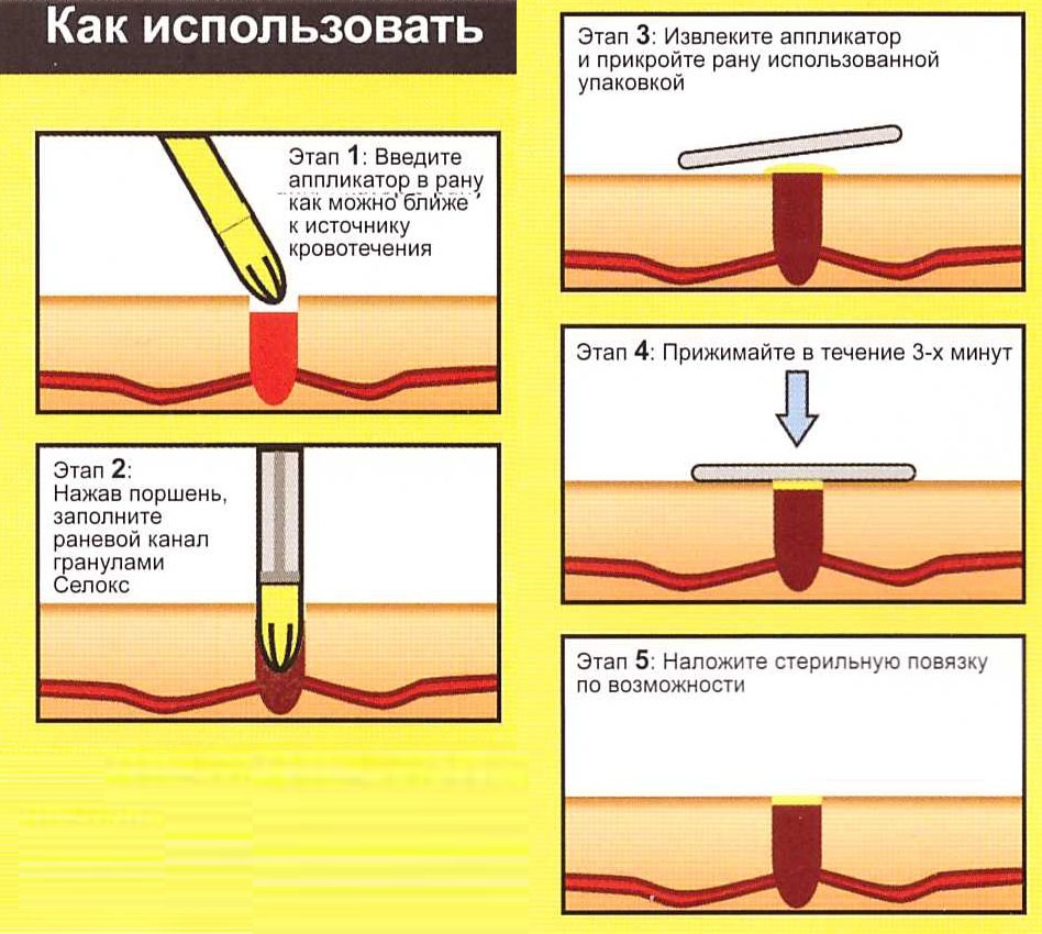 инструкция как использовать аппликатор с гемостатическими гранулами инструкция как использовать аппликатор с гемостатическими гранулами
