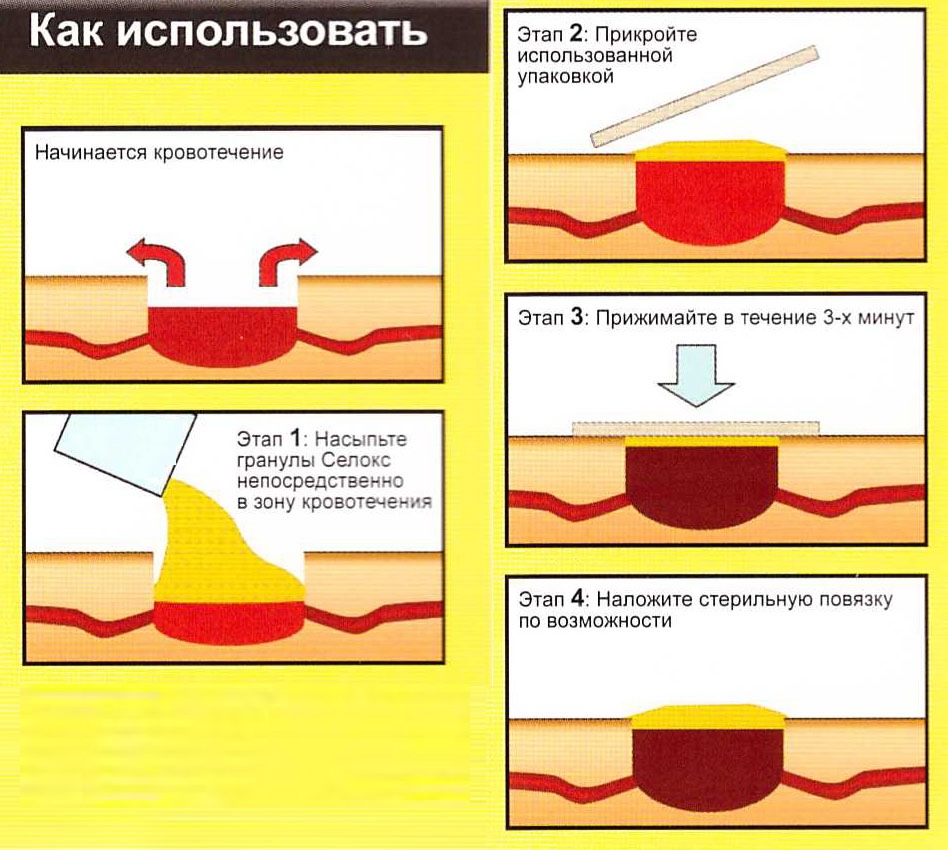 инструкция как использовать гемостатические гранулы инструкция как использовать гемостатические гранулы