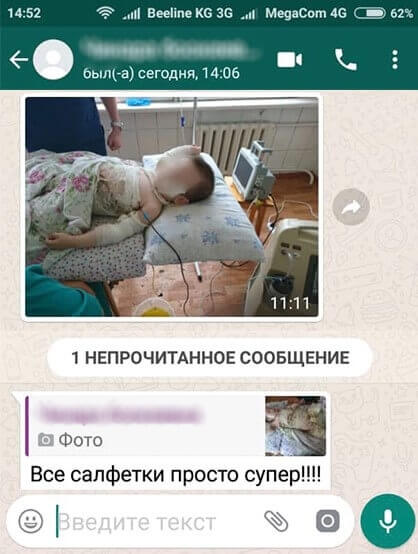 Все салфетки просто супер - сообщили врачи ожогового отделения Все повязки просто супер