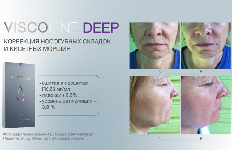 Viscoline® Deep_Висколайн Дип_3 Viscoline® Deep_Висколайн Дип_3.jpg