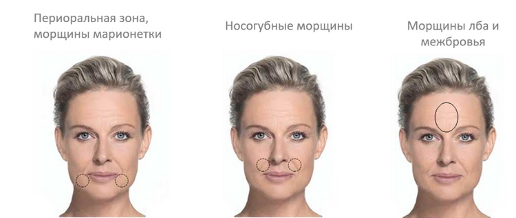 Viscoline® Balance_Висколайн Баланс_2 Viscoline® Balance_Висколайн Баланс_2.jpg