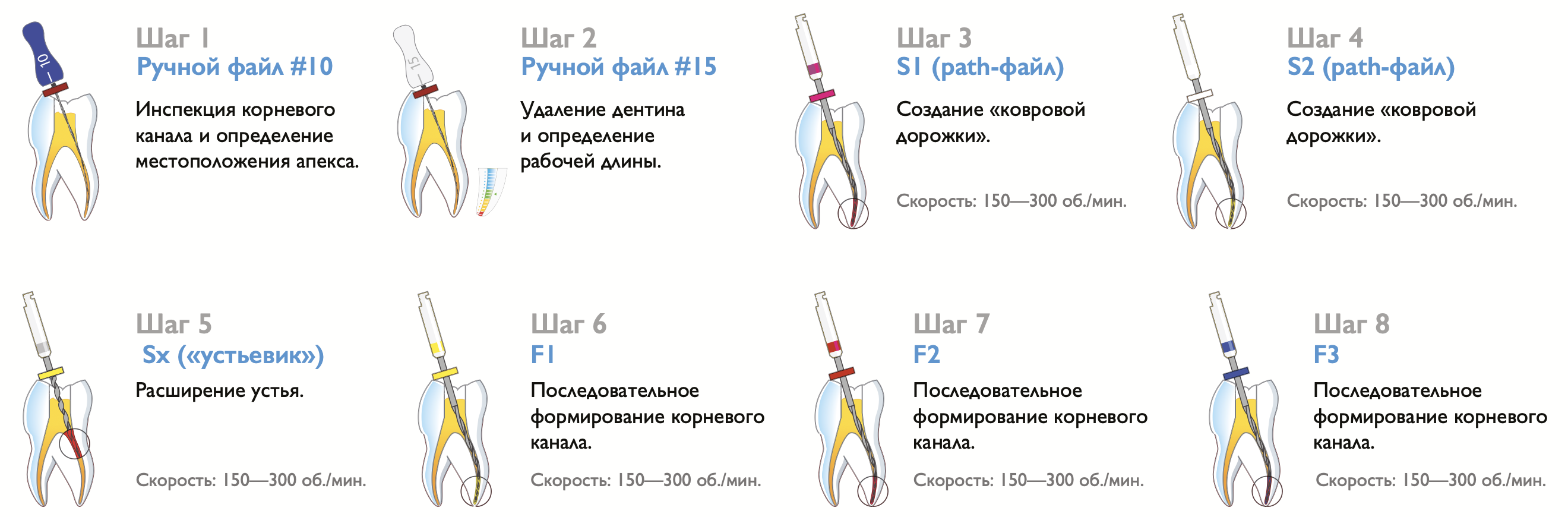 Протейперы Soco Super Files для первичного эндо - Протокол работы