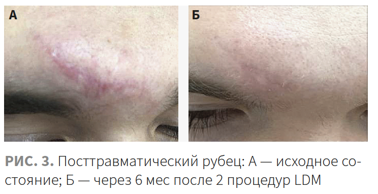 Гайдаш КМ 2-2023 (ННК) Рис 3.png
