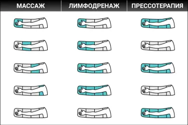 Надув камер манжеты на руку Надув камер в режимах массаж, лимфодренаж и прессотерапия