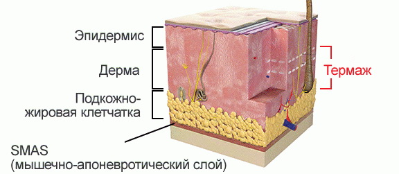 СМАС-лифтинг-слой СМАС-лифтинг-слой.jpg