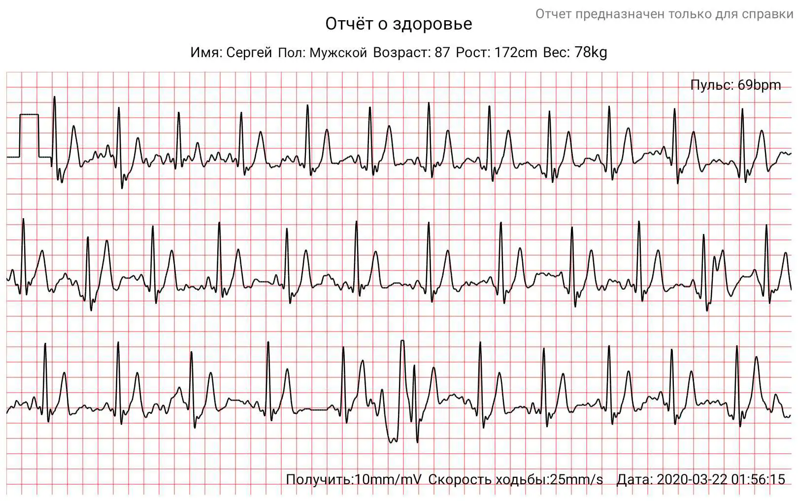 DrHofner-DH50-chornyy-glyanec-HEALTHBAND-EKG