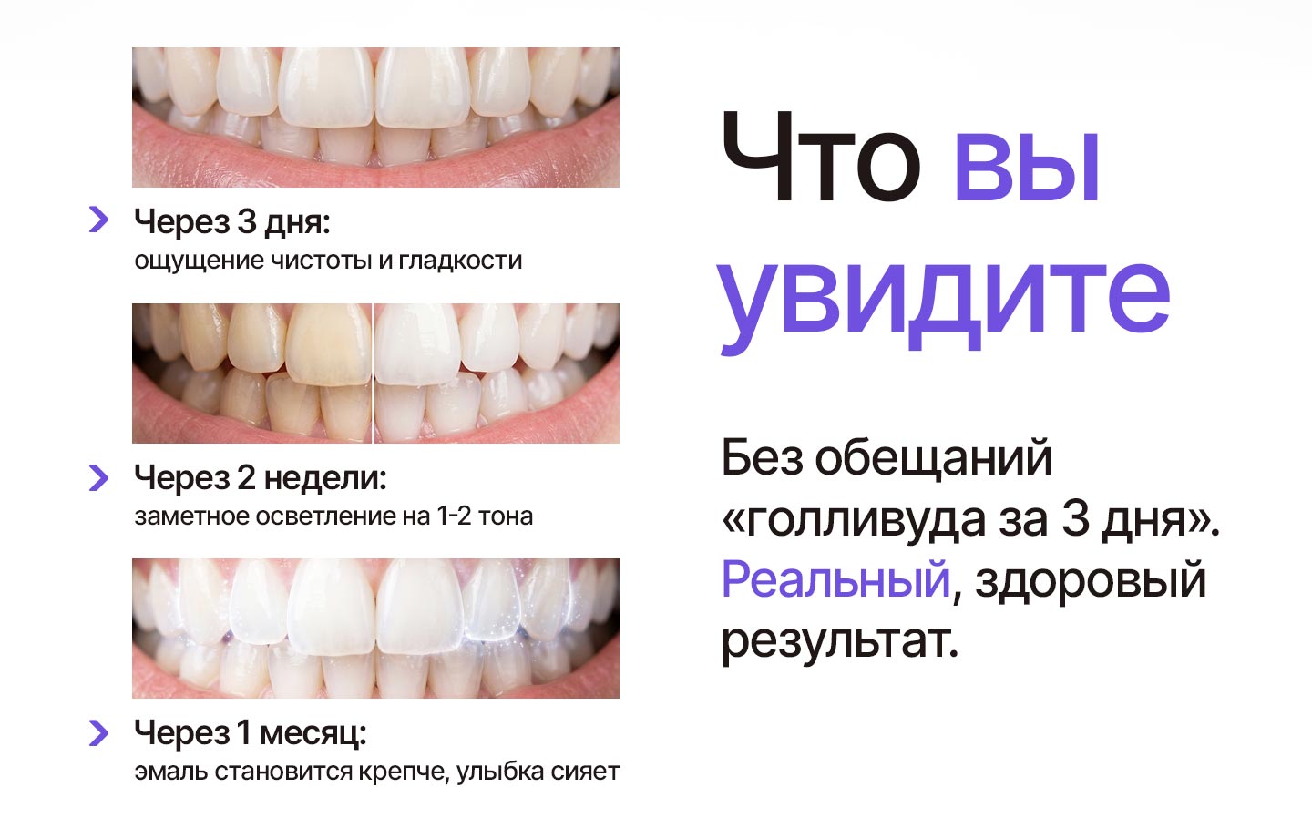 Результат применения фиолетовой пасты-корректора: более светлые зубы через 3 дня, 2 недели и 1 месяц
