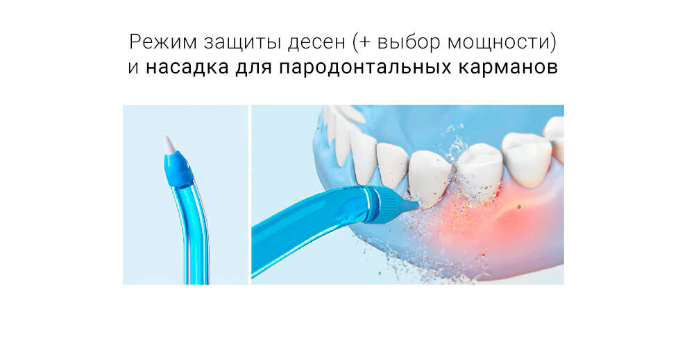 Ирригатор Soocas W3 Pro (4 насадки)