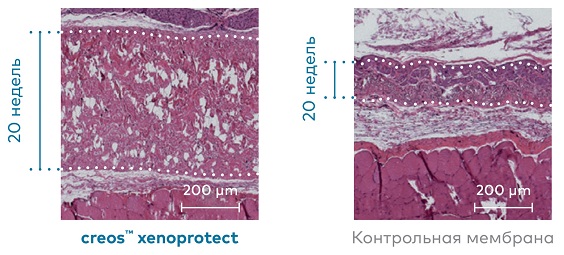 Устойчивость Creos Xenoprotect к резорбции Устойчивость Creos Xenoprotect к резорбции.jpg