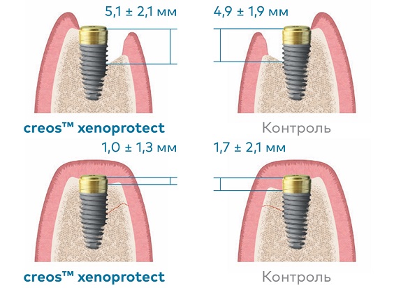 Влияние Creos Xenoprotect на формирование кости Влияние Creos Xenoprotect на формирование кости.jpg