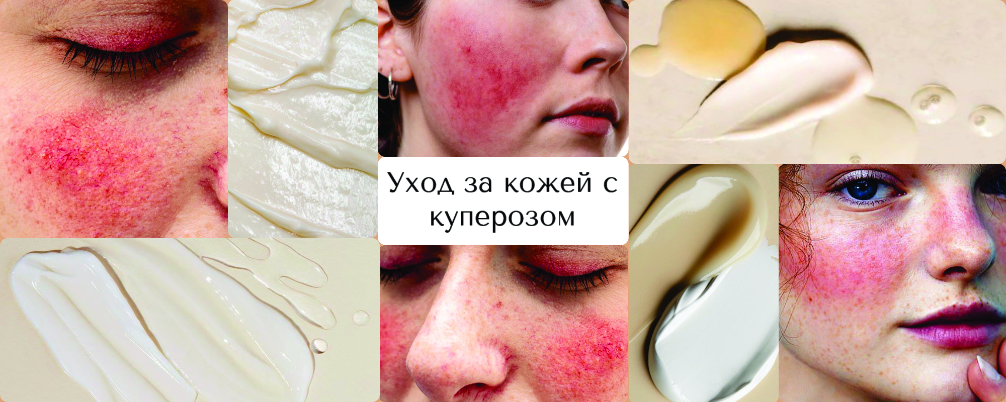 Уход за кожей с куперозом: особенности и советы