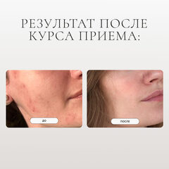 PROBIOLAB COLLAGEN (FISH) POWDER PURE PEPTIDES Морской коллаген (рыбий) порошок чистые пептиды 150 гр