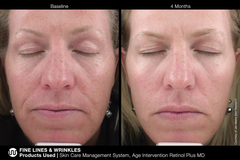 JAN MARINI AGE INTERVENTION RETINOL PLUS MD 1% Крем-акселератор с ретинолом 1% для борьбы с видимыми возрастными изменениями