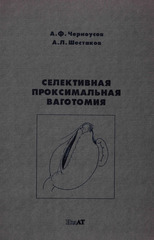 Селективная проксимальная ваготомия