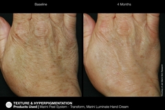 JAN MARINI RENU CORRECTIVE HAND COMPLEX Антивозрастной корректирующий крем для рук