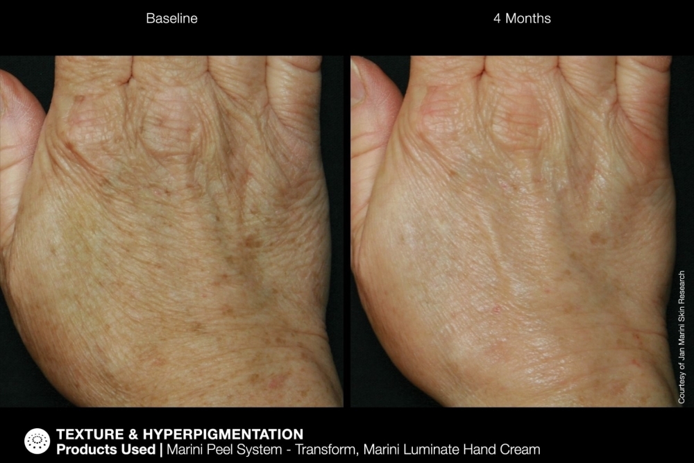 JAN MARINI RENU CORRECTIVE HAND COMPLEX Антивозрастной корректирующий крем для рук