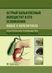 Острый калькулезный холецистит и его осложнения: новое о холелитиазе