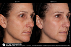 JAN MARINI AGE INTERVENTION RETINOL+ 0,5% Крем-акселератор с ретинолом 0,5% для борьбы с видимыми возрастными изменениями