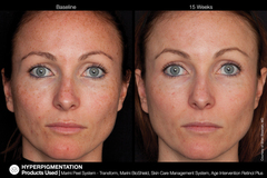 JAN MARINI AGE INTERVENTION RETINOL+ 0,5% Крем-акселератор с ретинолом 0,5% для борьбы с видимыми возрастными изменениями