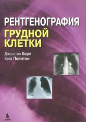 Рентгенография грудной клетки