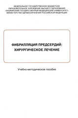 Фибрилляция предсердий: хирургическое лечение