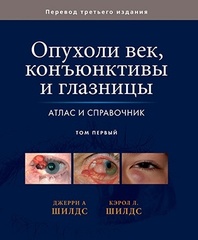 Опухоли век, конъюнктивы и глазницы. Атлас и справочник. Том 1