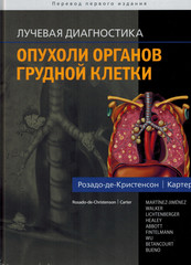 Лучевая диагностика. Опухоли органов грудной клетки