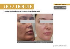 EVIPRO ANTI-AGE HYDRO-LIPID SYSTEM Омолаживающий комплекс (сыворотка 30мл, крем 30мл)