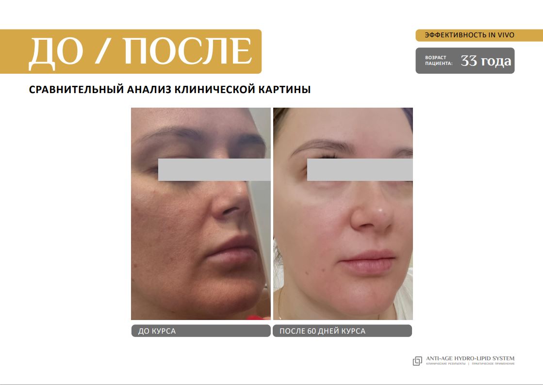 EVIPRO ANTI-AGE HYDRO-LIPID SYSTEM Омолаживающий комплекс (сыворотка 30мл, крем 30мл)