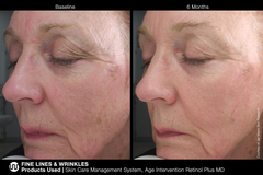 MARINI SKINSOLUTIONS AGE INTERVENTION RETINOL PLUS XC 1% Крем-акселератор с ретинолом 1% для борьбы с видимыми возрастными изменениями
