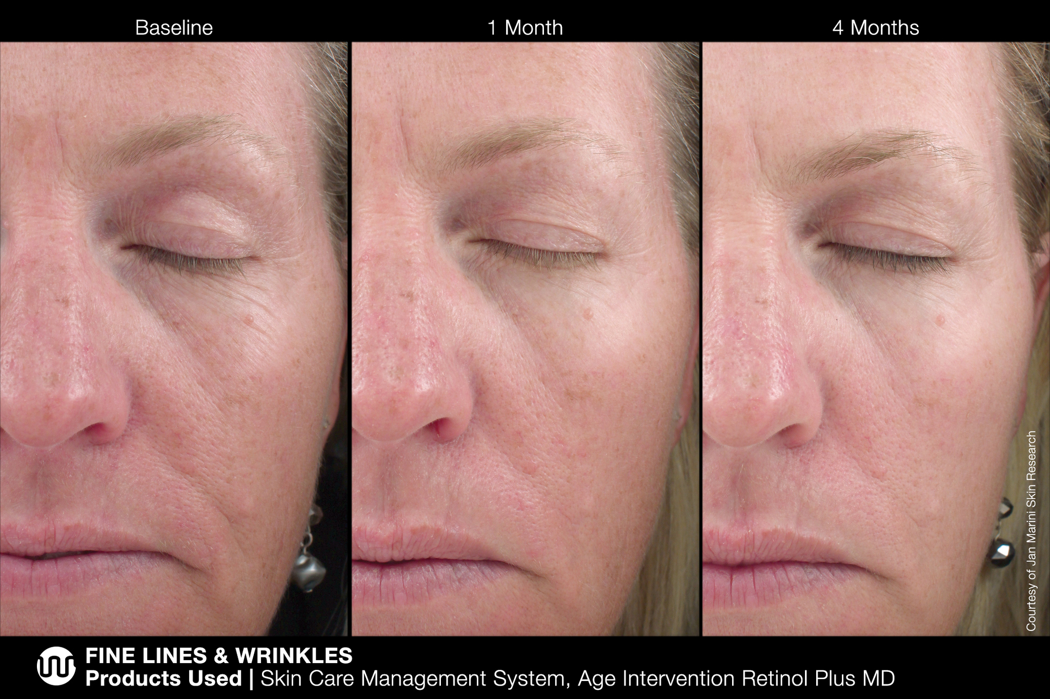 MARINI SKINSOLUTIONS AGE INTERVENTION RETINOL PLUS XC 1% Крем-акселератор с ретинолом 1% для борьбы с видимыми возрастными изменениями