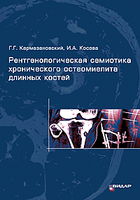 Лучевая диагностика Рентгенологическая семиотика хронического остеомиелита длинных костей Рентгенологическая_семиотика_хронического_остеомиелита_длинных_костей.gif