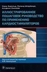 Иллюстрированное пошаговое руководство по применению кардиостимуляторов