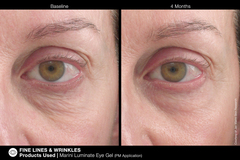 JAN MARINI LUMINATE EYE GEL Концентрированная сыворотка для кожи вокруг глаз с эффектом сияния против темных кругов и морщин
