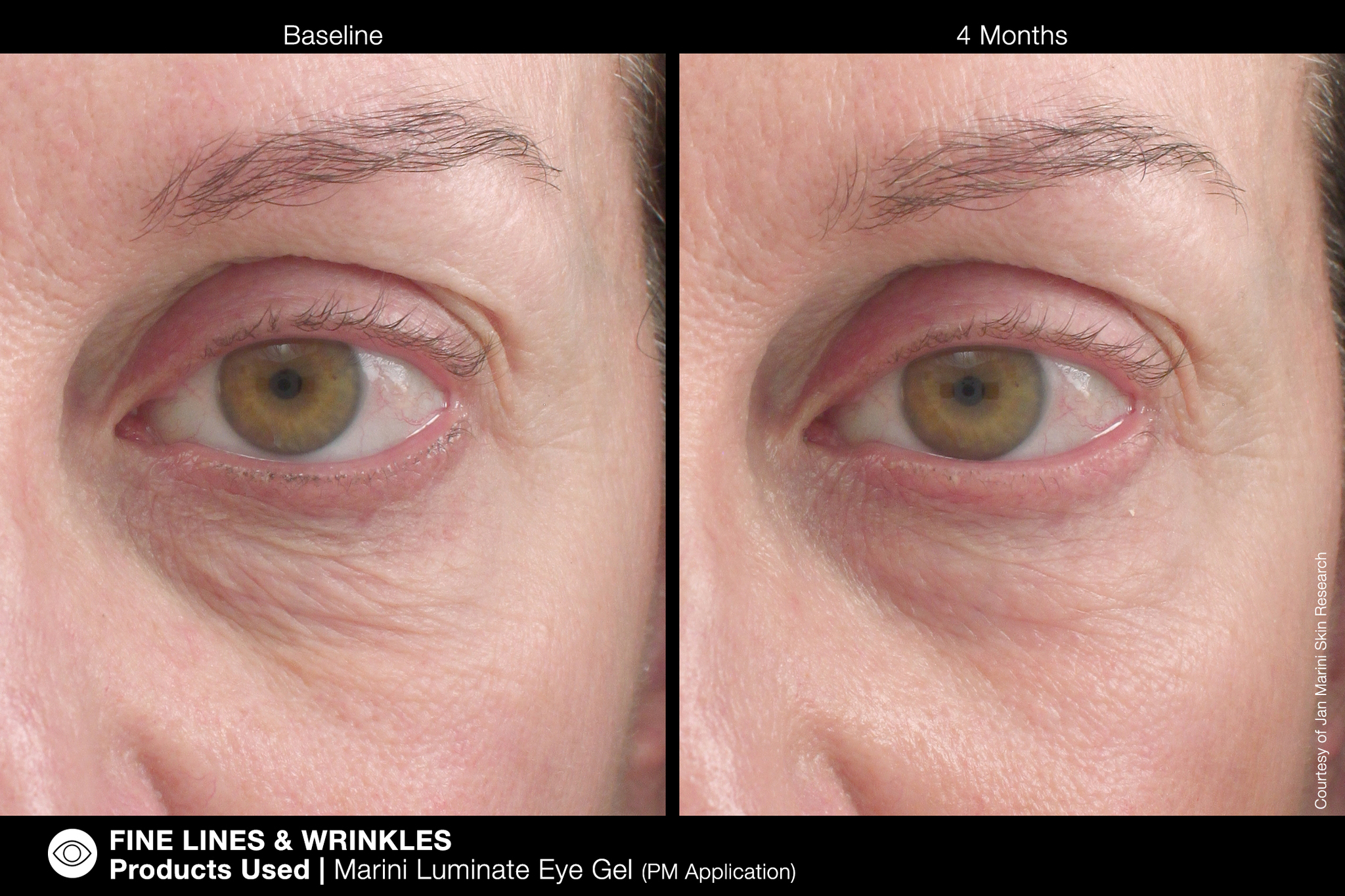 JAN MARINI LUMINATE EYE GEL Концентрированная сыворотка для кожи вокруг глаз с эффектом сияния против темных кругов и морщин