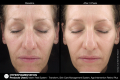 JAN MARINI AGE INTERVENTION RETINOL+ 0,5% Крем-акселератор с ретинолом 0,5% для борьбы с видимыми возрастными изменениями