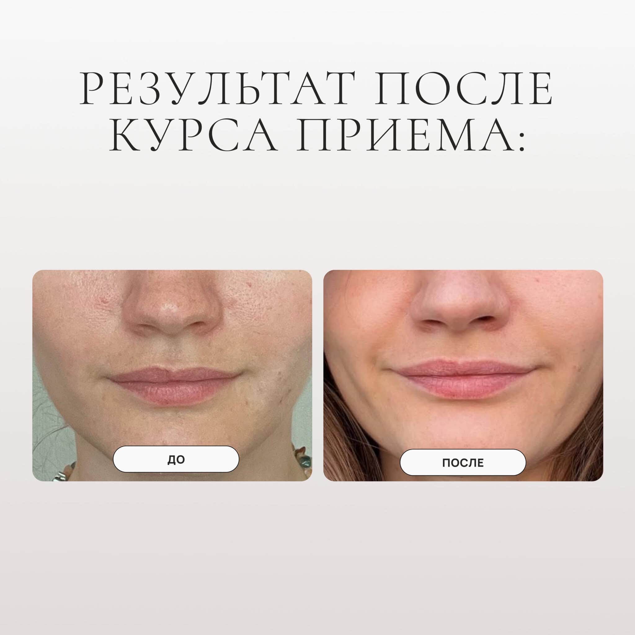 PROBIOLAB COLLAGEN (FISH) LIQUID Морской коллаген (рыбий) питьевой 250 мл