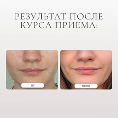 PROBIOLAB COLLAGEN (FISH) LIQUID Морской коллаген (рыбий) питьевой 250 мл
