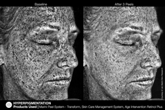 JAN MARINI AGE INTERVENTION RETINOL+ 0,5% Крем-акселератор с ретинолом 0,5% для борьбы с видимыми возрастными изменениями