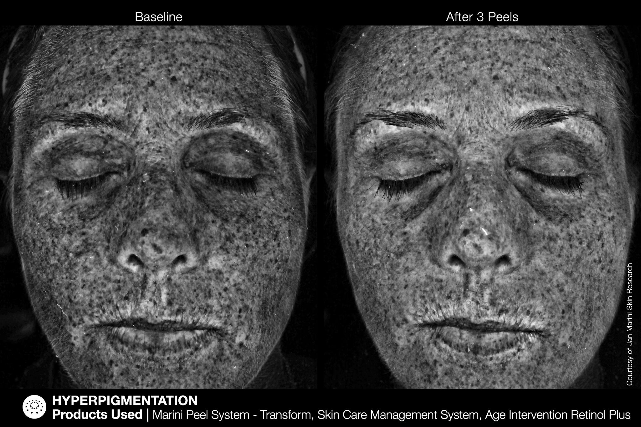 JAN MARINI AGE INTERVENTION RETINOL+ 0,5% Крем-акселератор с ретинолом 0,5% для борьбы с видимыми возрастными изменениями